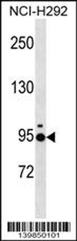 JAKMIP2 Antibody (Center)