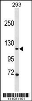 PGR/PR Antibody (C-term)