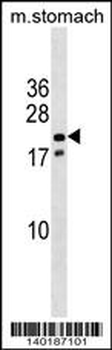 Mouse Nkx3-1 Antibody (Center)