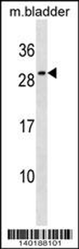 Mouse Il27 Antibody (Center)