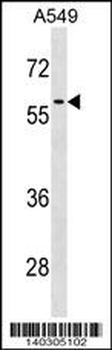 RCC2 Antibody (Center)
