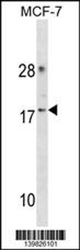CDK2AP2 Antibody(Center)