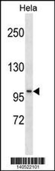 SSH1 Antibody(N-term)