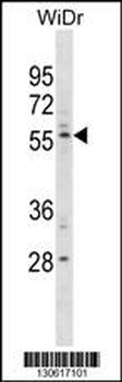 PLXDC1 Antibody(C-term)
