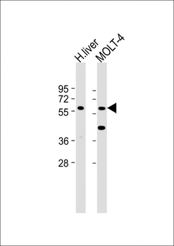GLT8D4 Antibody(C-term)