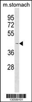 COLQ Antibody(C-term)