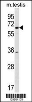 SRRM3 Antibody(Center)