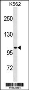 STARD13 Antibody(Center)