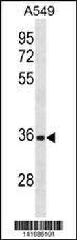CD5L Antibody (N-term)