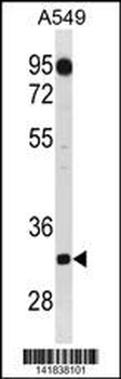C1QTNF2 Antibody (C-term)