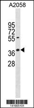 AVEN Antibody (N-term)