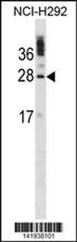 CIB1 Antibody (C-term)