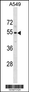 PUS10 Antibody (N-term)