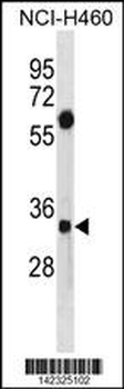 SDCBP Antibody (N-term)