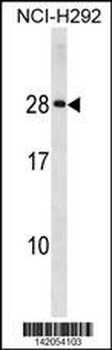 HLA-DQA2 Antibody (Center)
