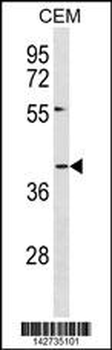DARC Antibody (N-term)