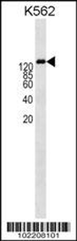 P-Glycoprotein (ABCB1) Antibody (Center)
