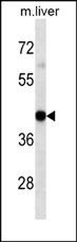 HLA-A Antibody(Center)