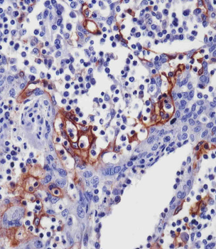 PD L1 Monoclonal Antibody (PDL1)