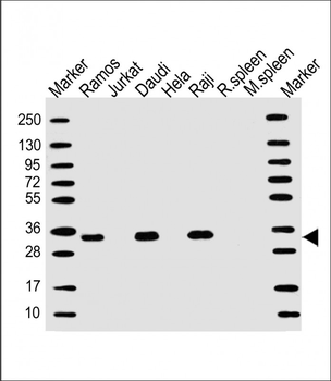 MS4A1/CD20 Antibody (C-term)