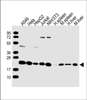 RPS7 Antibody (N-Term)
