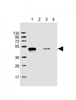 GST Tag Antibody