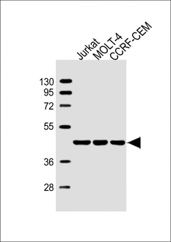 ADA Antibody (C-term)