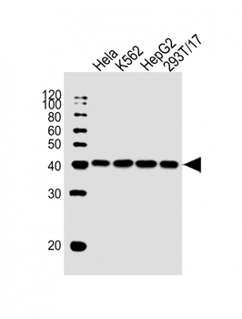 PCBP1 Antibody (Center)