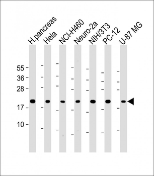 TMED10 Antibody (C-term)