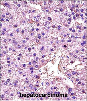 LDHA Antibody (C-term)