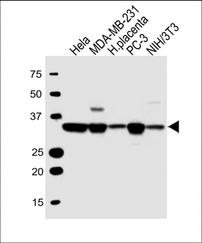 LDHA Antibody (C-term)