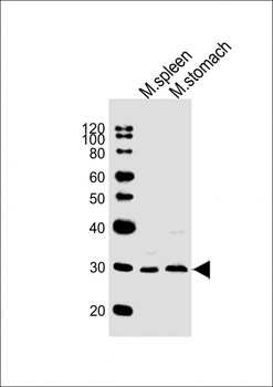 Mouse Nkx2-5 Antibody (Center)