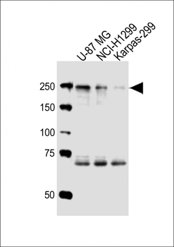 ROS1 Antibody (C-term)