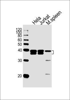 NPM1 Antibody (N-term)