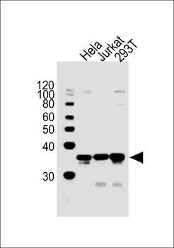 AKR1B1 Antibody (Center)