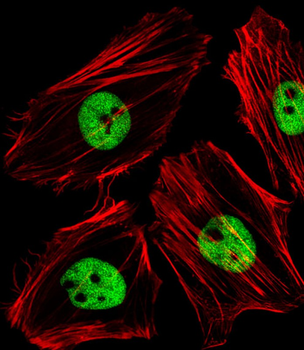 (Mouse) Smarcc1 Antibody (C-term)