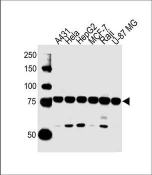 IMMT Antibody (Center)