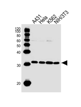 CDK5 Antibody (C-term)