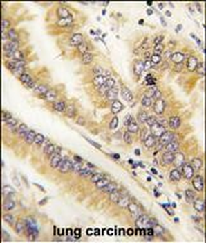 AGR2 Antibody (N-term)
