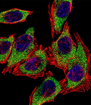 AGR2 Antibody (N-term)