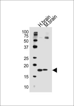 SNCA Antibody (C-term)