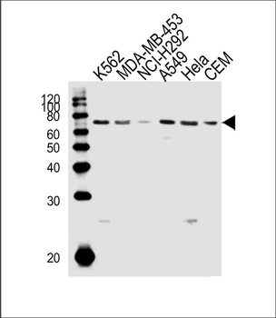 PARP3 Antibody (N-term)