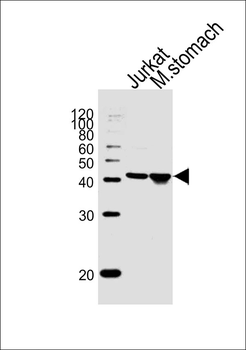 ADA Antibody (C-term)