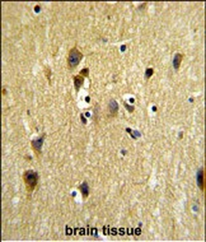 STIP1 Antibody (Center)