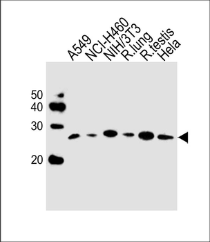 R Cebpd Antibody (Center)