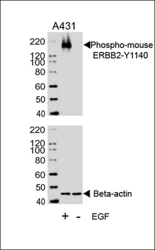 Phospho-M ERBB2(Y1140) Antibody