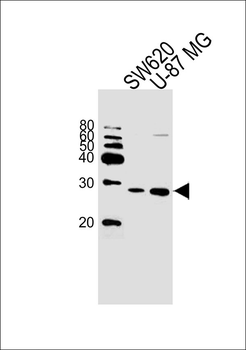 UCHL3 Antibody (C-term)