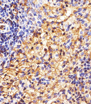 HLA-B Antibody (N-term)