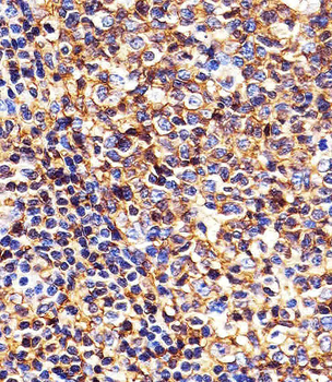 HLA-B Antibody (N-term)