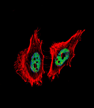 CTBP1 Antibody (C-term)